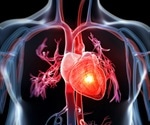 Mental disorders in adults aged 20–39 years linked to elevated risk of heart attack and stroke