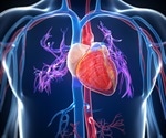 ATTR amyloidosis cardiomyopathy can be reversed, study reports