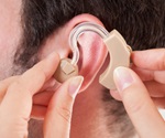 Developmental exposure to PCBs blocks hearing recovery from acoustic trauma