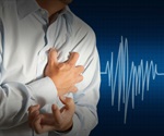 Heart attack patients with concurrent COVID-19 have higher mortality risk, research shows